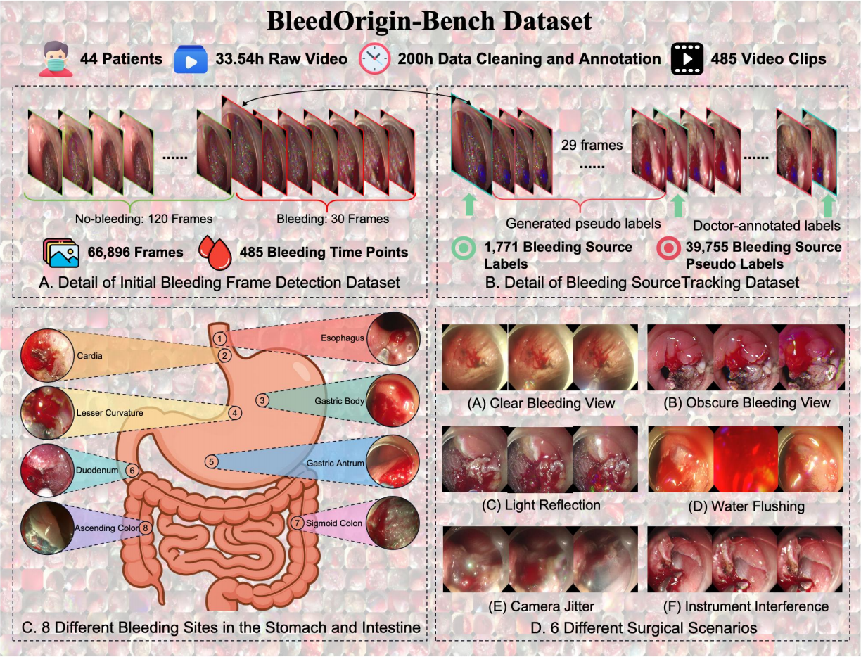 BleedOrigin-Bench dataset composition and clinical diversity