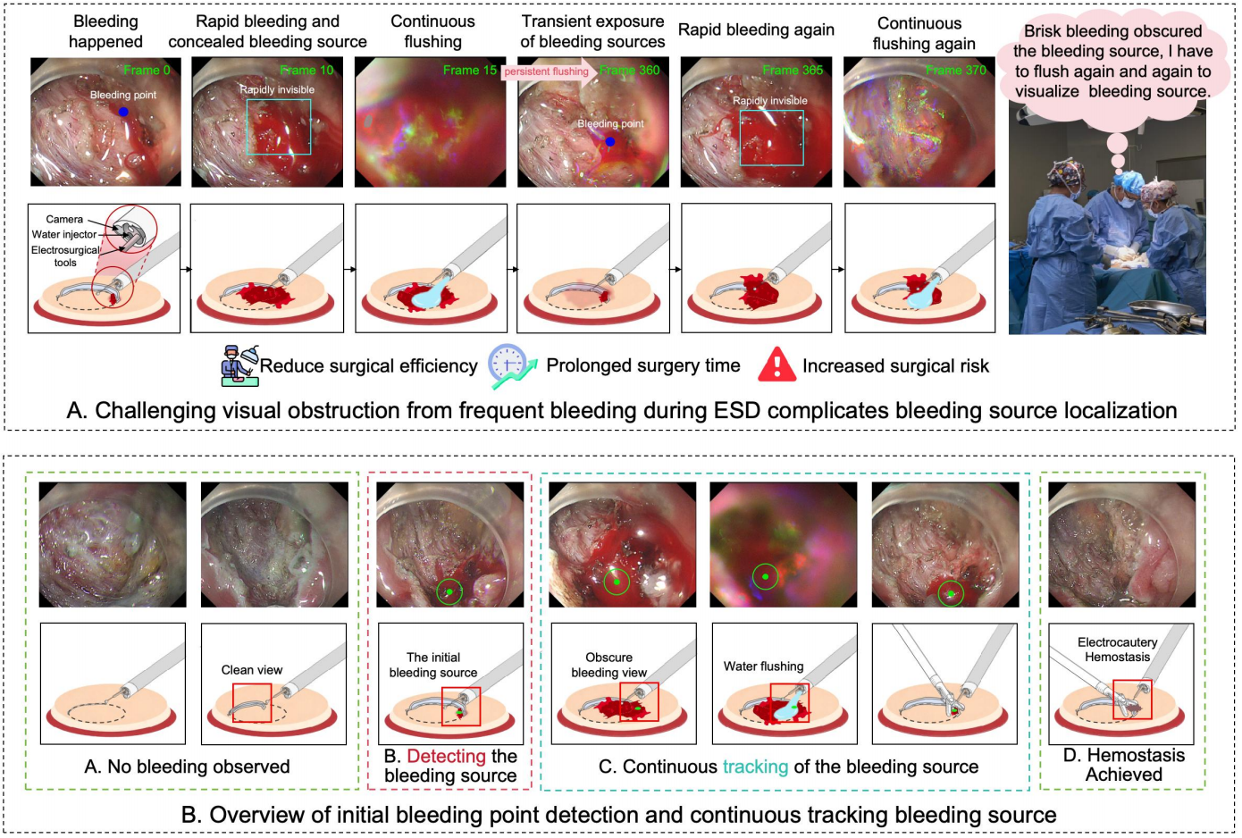 Clinical motivation and BleedOrigin detection-tracking workflow