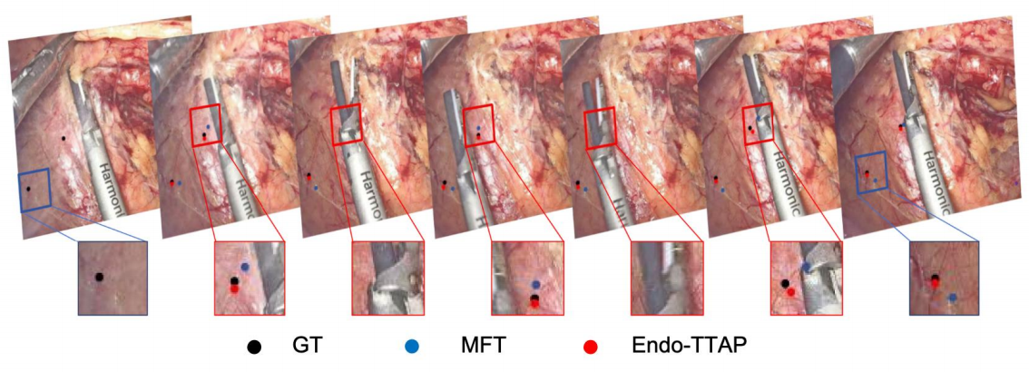 Endoscopic sequence showing ground-truth, MFT, and Endo-TTAP tracked points